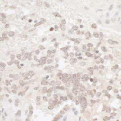 Immunohistochemistry-Paraffin: Casein Kinase 2 alpha Antibody [NB100-377]