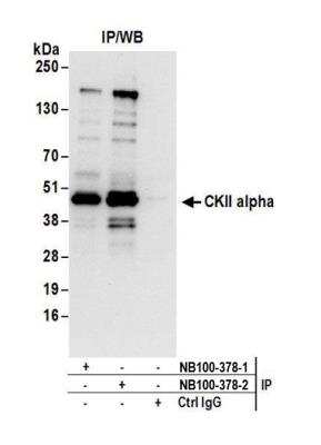 Immunoprecipitation: Casein Kinase 2 alpha Antibody [NB100-378]