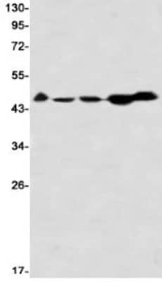 Western Blot: Casein Kinase 2 alpha Antibody (S05-7F8) [NBP3-19853]