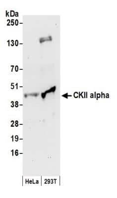 Western Blot: Casein Kinase 2 alpha Antibody [NB100-376]