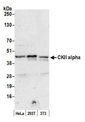 Western Blot: Casein Kinase 2 alpha Antibody [NB100-377]