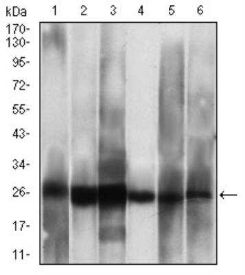 Western Blot: Casein Kinase 2 beta Antibody (1H8A5)BSA Free [NBP2-52450]