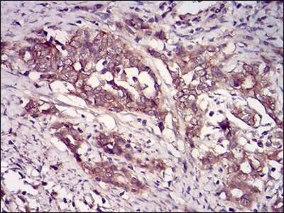 Immunohistochemistry: Casein Kinase 2 beta Antibody (2F12F3) - BSA Free [NBP2-52449]