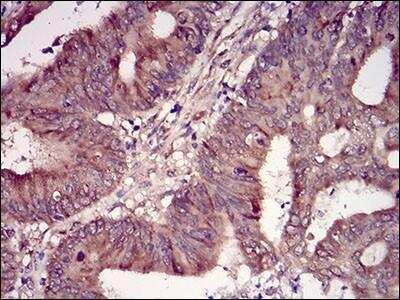 Immunohistochemistry: Casein Kinase 2 beta Antibody (2F12F3) - BSA Free [NBP2-52449]