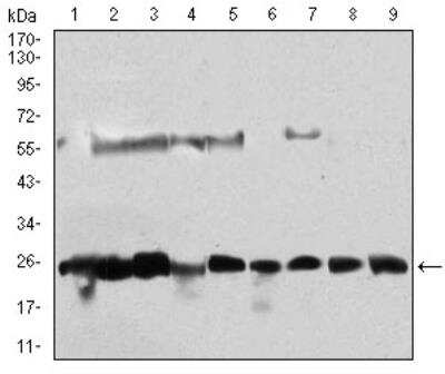 Western Blot: Casein Kinase 2 beta Antibody (2F12F3)BSA Free [NBP2-52449]