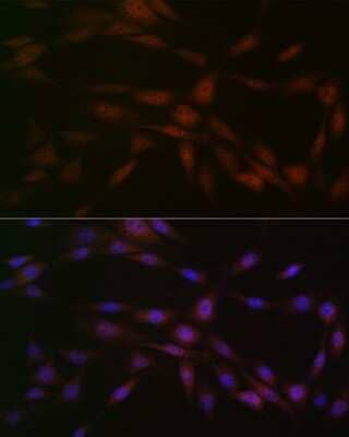 Immunocytochemistry/ Immunofluorescence: Casein Kinase 2 beta Antibody (9T5J10) [NBP3-16264]