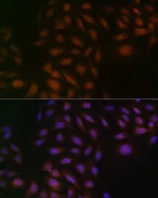 Immunocytochemistry/ Immunofluorescence: Casein Kinase 2 beta Antibody (9T5J10) [NBP3-16264]