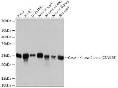 Western Blot: Casein Kinase 2 beta Antibody (9T5J10) [NBP3-16264]