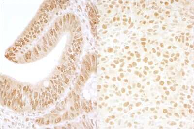 Immunohistochemistry: Casein Kinase 2 beta Antibody [NBP1-06514]