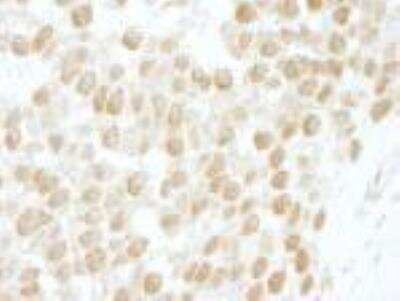 Immunohistochemistry-Paraffin: Casein Kinase 2 beta Antibody [NBP1-06514]
