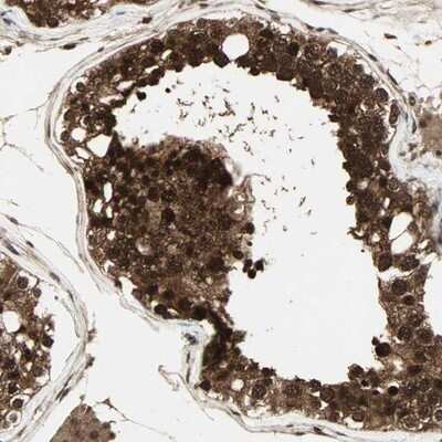 Immunohistochemistry-Paraffin: Casein Kinase 2 beta Antibody [NBP1-87483]
