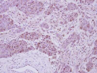 Immunohistochemistry-Paraffin: Casein Kinase 2 beta Antibody [NBP2-21570]