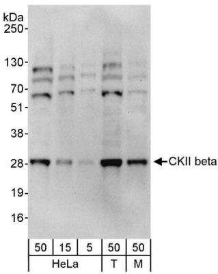 Western Blot: Casein Kinase 2 beta Antibody [NBP1-06514]