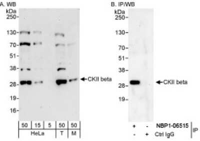 Western Blot: Casein Kinase 2 beta Antibody [NBP1-06515]