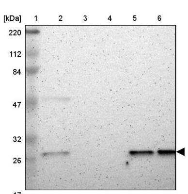 Western Blot: Casein Kinase 2 beta Antibody [NBP1-87483]