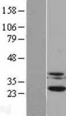 Western Blot: Casein Kinase 2 beta Overexpression Lysate [NBL1-09538]