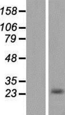 Western Blot: Casein Overexpression Lysate [NBP2-10769]