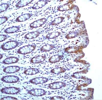 Immunohistological Staining of Caspase-1 in Paraffin Embedded Human Colon