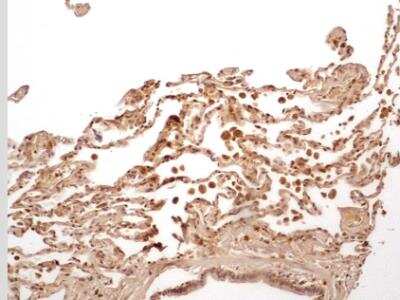Immunohistological Staining of Caspase-1 in Paraffin Embedded Human Lung