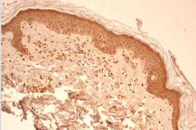 Immunohistological Staining of Caspase-1 in Paraffin Embedded Human Skin