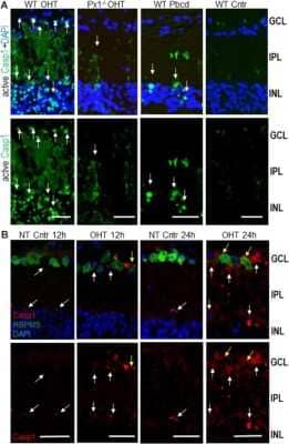 Immunohistological Staining of Caspase-1 in Control and OHT-Injured Mouse Eyes