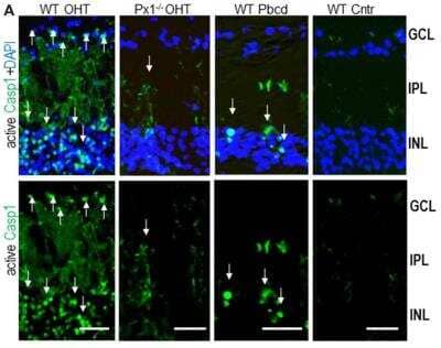 Immunohistological Staining of Caspase-1 in Control and OHT-Injured Mouse Eyes