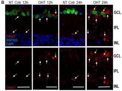 Immunohistological Staining of Caspase-1 in Control and OHT-Injured Mouse Eyes