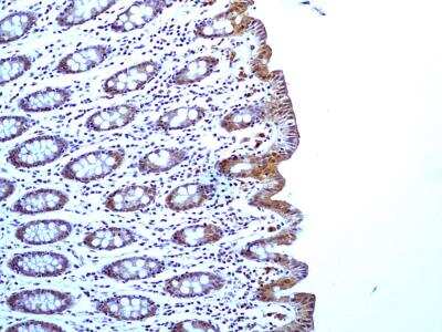 Immunohistological Staining of Caspase-1 in Paraffin Embedded Human Colon