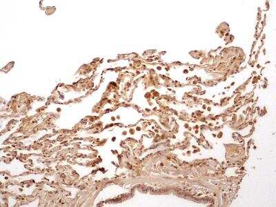 Immunohistological Staining of Caspase-1 in Paraffin Embedded Human Lung