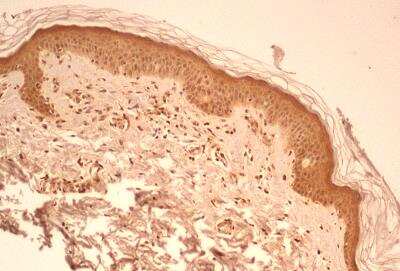 Immunohistological Staining of Caspase-1 in Paraffin Embedded Human Skin