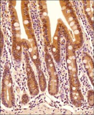 Immunohistological Staining of Caspase-1 in Paraffin Embedded Human Intestine
