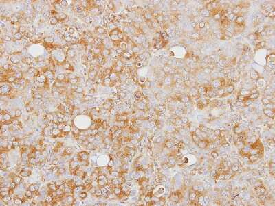 Immunohistochemistry-Paraffin: Caspase-1 Antibody [NBP2-15713]