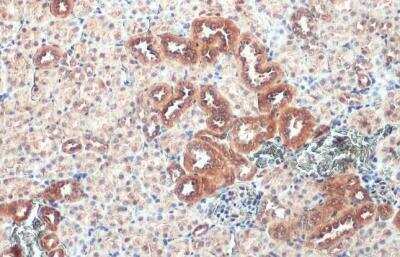 Immunohistochemistry-Paraffin: Caspase-1 Antibody [NBP2-15713]