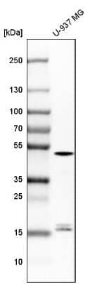 Western Blot: Caspase-1 Antibody [NBP1-87680]