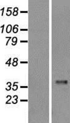 Western Blot: Caspase-1 Overexpression Lysate [NBL1-08706]