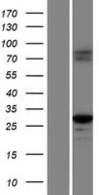 Western Blot: Caspase-1 Overexpression Lysate [NBP2-05896]