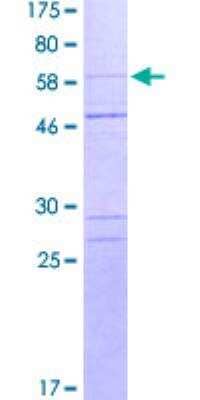 SDS-PAGE: Recombinant Human Caspase-1 GST (N-Term) Protein [H00000834-P01]