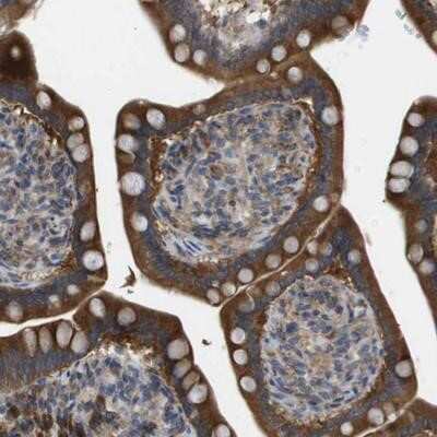 Immunohistochemistry-Paraffin: Caspase-10/FLICE2 Antibody [NBP1-87685]