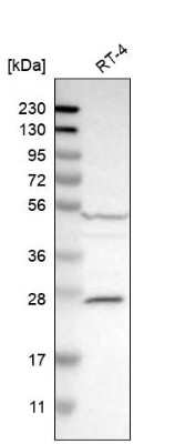 Western Blot: Caspase-10/FLICE2 Antibody [NBP1-87685]