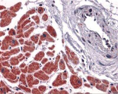 Immunohistochemistry-Paraffin: Caspase-12 Antibody - BSA Free [NBP2-31179]