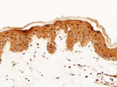 Immunohistochemistry-Paraffin: Caspase-14 Antibody (001) [NBP3-05780]