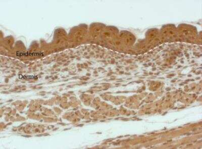 Immunohistochemistry: Caspase-14 Antibody [NB100-56126]