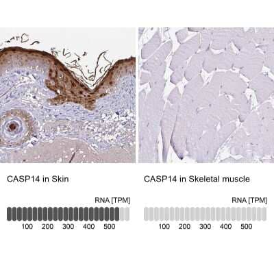 Immunohistochemistry-Paraffin: Caspase-14 Antibody [NBP2-33906]