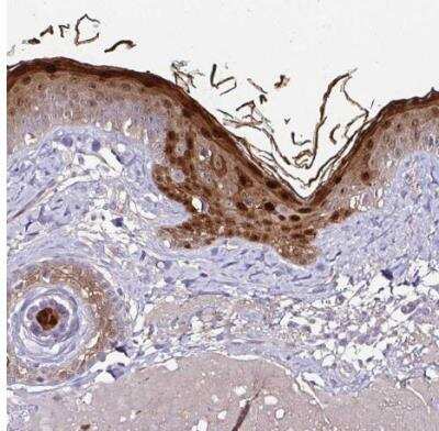Immunohistochemistry-Paraffin: Caspase-14 Antibody [NBP2-33906]
