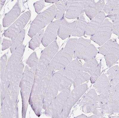 Immunohistochemistry-Paraffin: Caspase-14 Antibody [NBP2-33906]