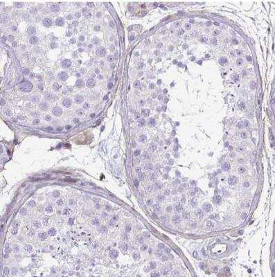 Immunohistochemistry-Paraffin: Caspase-14 Antibody [NBP2-33906]