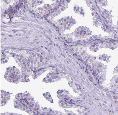 Immunohistochemistry-Paraffin: Caspase-14 Antibody [NBP2-33906]