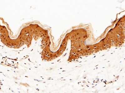 Immunohistochemistry-Paraffin: Caspase-14 Antibody [NBP2-99889]