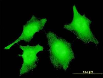 Immunocytochemistry/ Immunofluorescence: Caspase-2 Antibody (1C11) - (active/cleaved) [H00000835-M10]