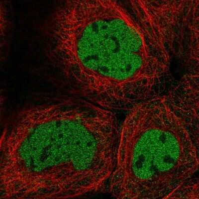 Immunocytochemistry/ Immunofluorescence: Caspase-2 Antibody [NBP2-38635]